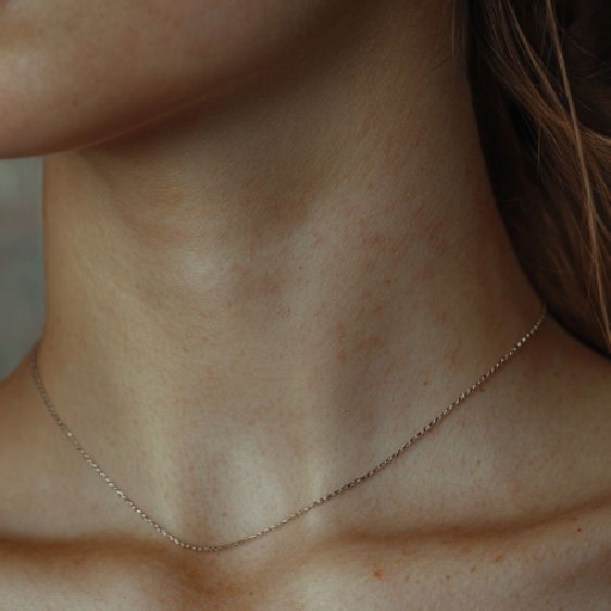 Rugas do pescoço: por que elas acontecem e como se livrar deles